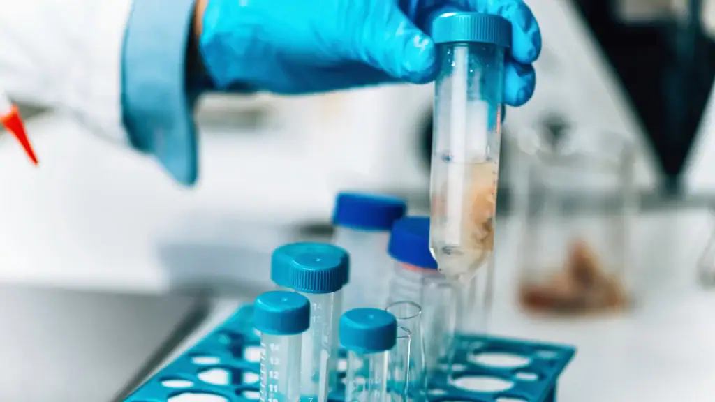 control de calidad del agua tratadaUntitled design 2